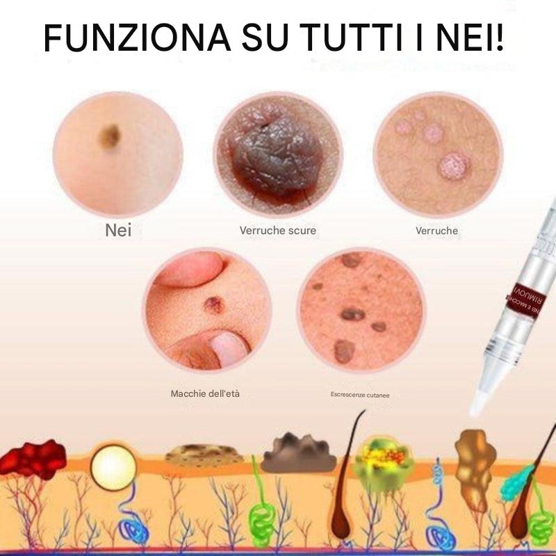 Rimozione di etichette e nei